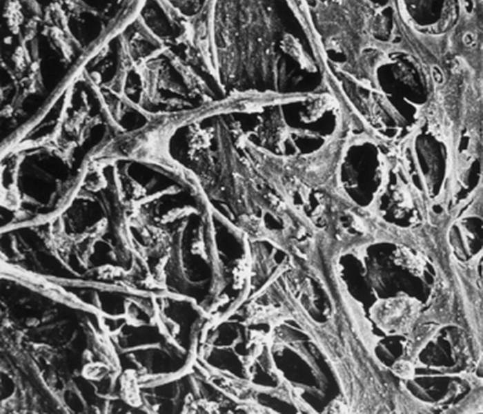 trabecular-meshwork-slt-400