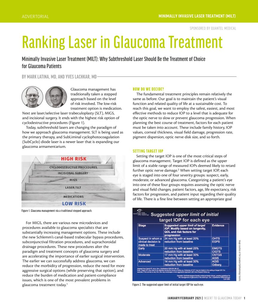 Ranking Laser in Treatment Glass